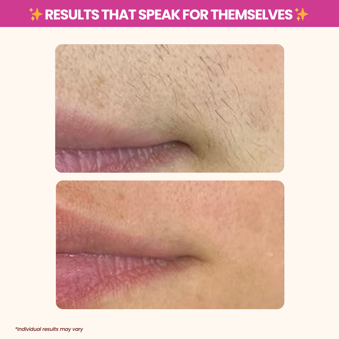 Cyperus Rotundus Oil - Natural Hair Removal & Moisturizing Oil