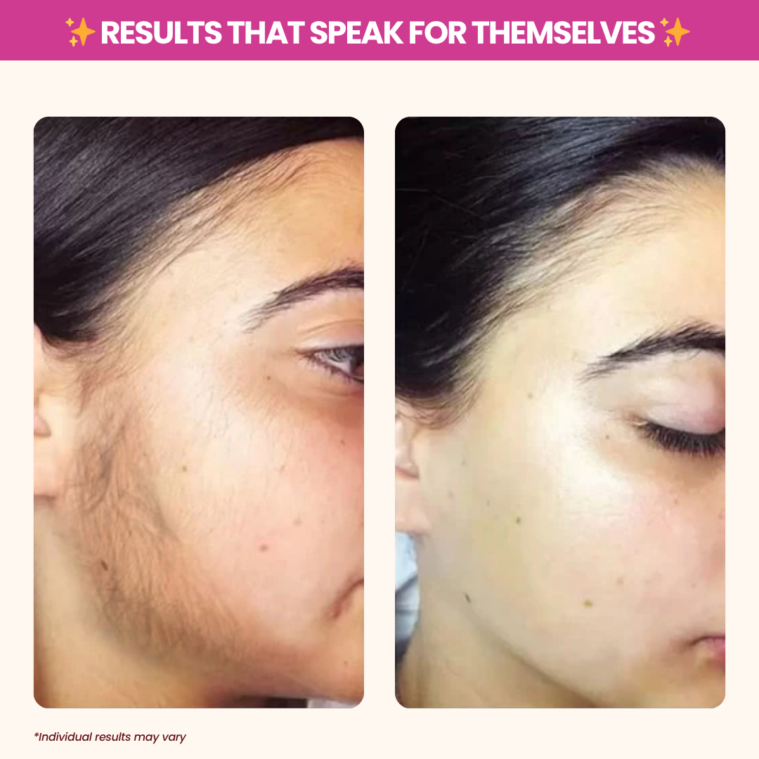 Cyperus Rotundus Oil - Natural Hair Removal & Moisturizing Oil